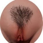 Implanted Pubic Hair